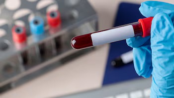 Japón anuncia que está desarrollando sangre artificial universal compatible con todos los tipos de sangre.
