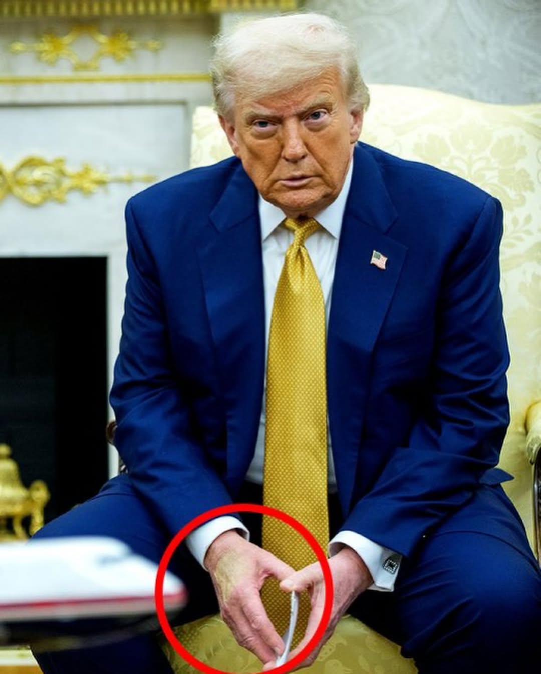 CRECEN RUMORES SOBRE LA SALUD DE TRUMP, FUENTES ALEGAN QUE PODRÍA HABER SUFRIDO UN DERRAME. HOY TENDRÁ RUEDA DE PRENSA.