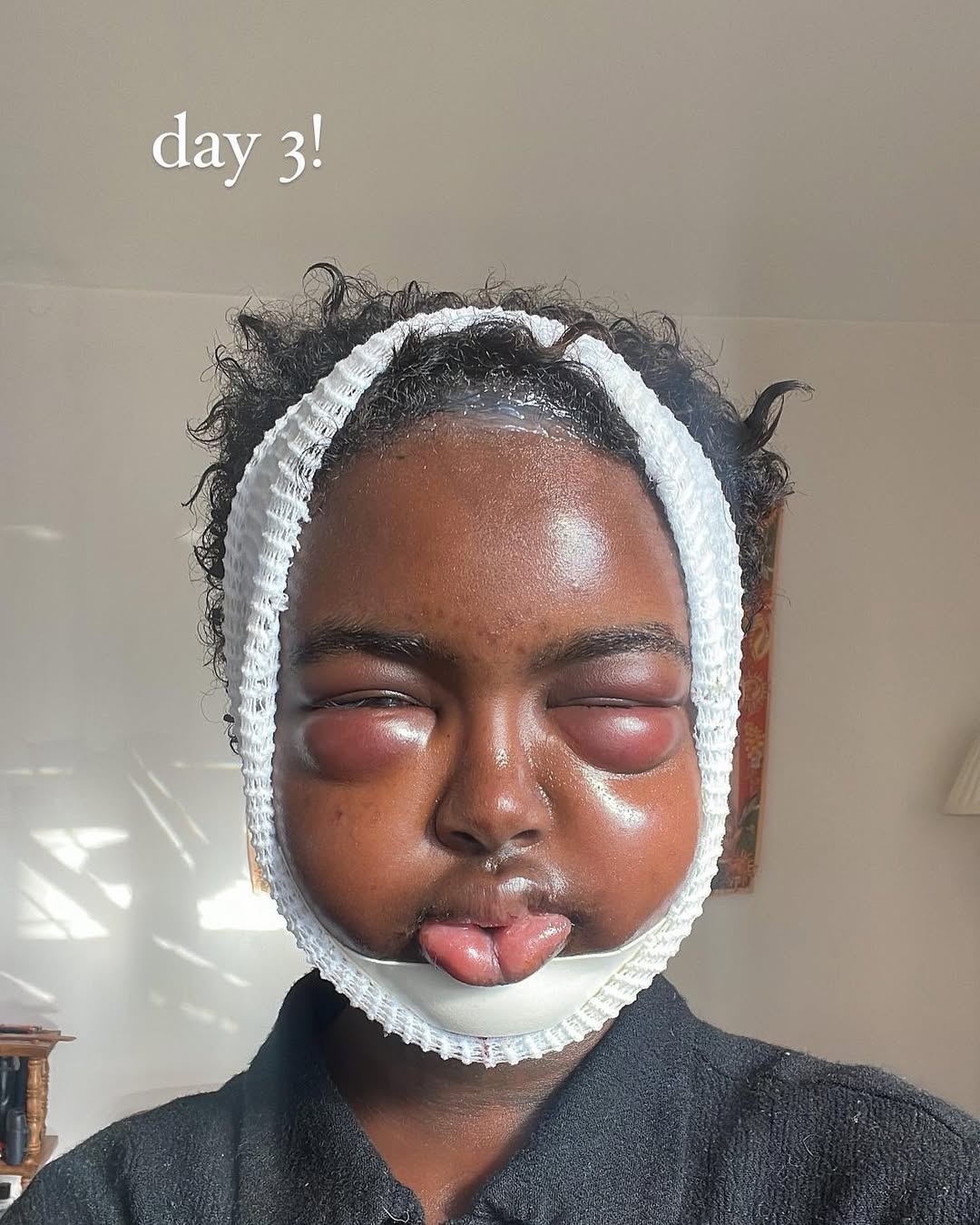 TIKTOKER COMPARTE SU PROCESO DE TRANSFORMACIÓN DE MUJER A HOMBRE Y MUESTRA CONTROVERSIAL RESULTADO